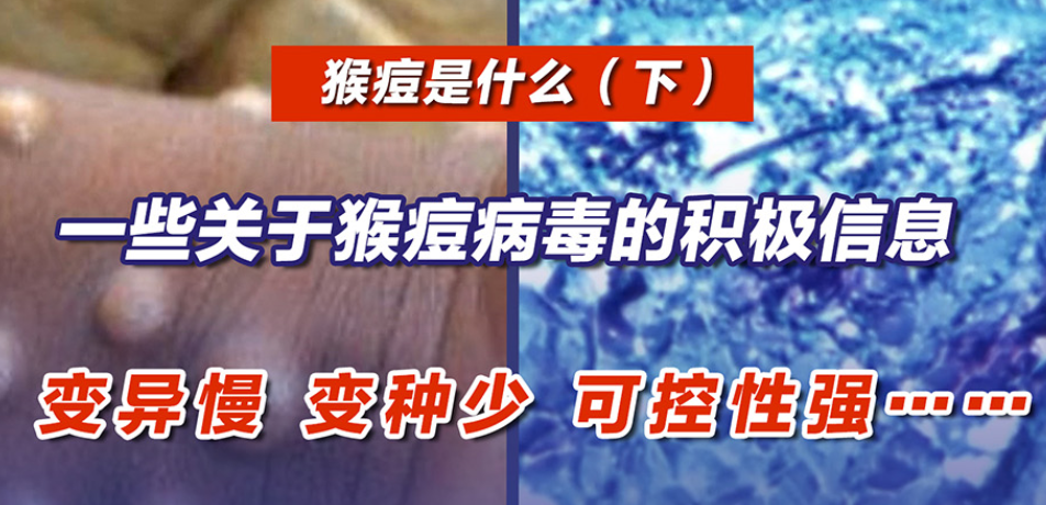 一些关于猴痘病毒的积极信息：变异慢、变种少、可控性强……