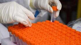 吉林市昨日新增本土确诊病例73例，新增本土无症状感染者65例