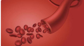 贫血，千万别忽视这项检查！